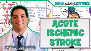 Acute Ischemic Stroke Etiology Pathophysiology Clinical Features Diagnostics Treatment [upl. by Alomeda]