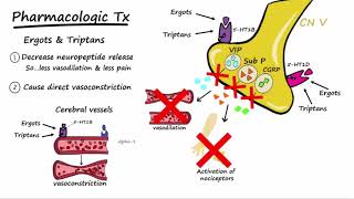 Migraines  Pathophysiology amp Treatment Described Concisely [upl. by Korff]