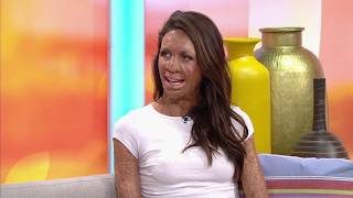 Turia Pitt on her passion for motherhood and life [upl. by Salim810]