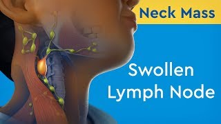 Axillary Lymph Nodes Dr Adel Bondok [upl. by Arikehs]