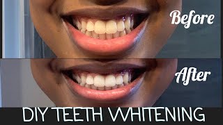 2 SIMPLE DIY HACKS FOR WHITENINGTEETH  MORE OF AALIYAH [upl. by Resaec221]