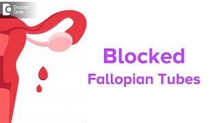 Blocked Fallopian Tubes Symptoms Fertility Issues amp Treatment  Dr Jyothi Patil  Doctors Circle [upl. by Salman442]