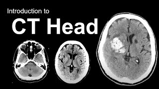 Diagnostic Imaging Explained XRay  CT Scan  Ultrasound  MRI [upl. by Annav]