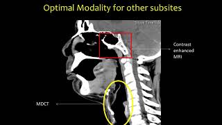 Head and Neck Anatomy Dr Abhishek Mahajan [upl. by Haroppizt]