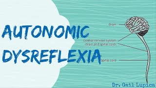 Hyperreflexia Hoffmans Sign Clonus 2 [upl. by Kola]