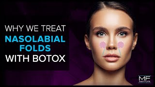 Using BOTOX® To Treat Nasolabial Folds at Mabrie Facial Institute [upl. by Nalek]