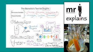 mr i explains The Benedicts test for Sugars [upl. by Rollecnahc241]