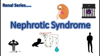 Nephrotic Syndrome  Animation  Pathophysiology  Clinical Features  Renal Series CH1 Part 1 [upl. by Naomi]