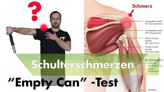 Schulterimpingement Testen  Supraspinatussehne Entzündet [upl. by Enecnarf]