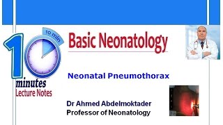 Neonatal Pneumothorax [upl. by Watts]