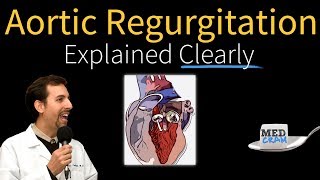 Aortic Regurgitation Insufficiency Explained Clearly [upl. by Aneertak581]