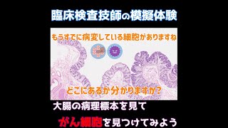 病理標本から「がん細胞」を見つける方法 [upl. by Kleiman249]