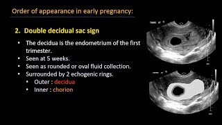 Ultrasound of normal early pregnancy [upl. by Deehsar]