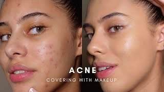 HOW TO COVER ACNE WITH MAKEUP BASE ROUTINE [upl. by Enirok]