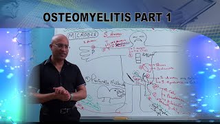 Osteomyelitis  Causes amp Symptoms  Bone Infection🩺 [upl. by Cicero90]