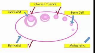 Ultrasound of Common Adnexal Cysts [upl. by Ellehciram984]