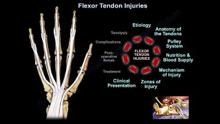 Flexor Tendon Injuries  Everything You Need To Know  Dr Nabil Ebraheim [upl. by Odlawso321]