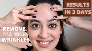 Forehead Massage To Reduce Wrinkles  Facial Yoga  FAST RESULTS  Sonali Beauty [upl. by Maybelle]