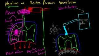 Negative vs Positive Pressure Ventilation [upl. by Anekam21]