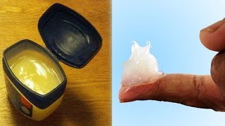 Reasons You Should Never Use Petroleum Jelly [upl. by Petuu]