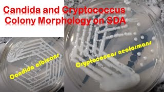 Candida and Cryptococcus colony morphology on SDA [upl. by Yekcin]