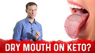 Why Dry Mouth On Keto Cotton Mouth – Dr Berg On Xerostomia amp Dry Mouth Causes [upl. by Kermit]