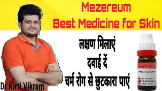 किस्सा क्लीनिक का  Mezereum  Kye Symptom  Fungal Infections  Eczema  Seborrheic dermatitis [upl. by Shanley536]