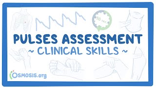 Clinical Skills Pulses assessment [upl. by Laroc715]