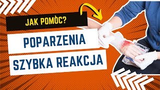 Poparzenie Co należy zrobić🚨 poparzenie [upl. by Sikata]