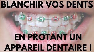 Comment Blanchir Vos Dents en Portant Un Appareil Dentaire [upl. by Ienttirb273]