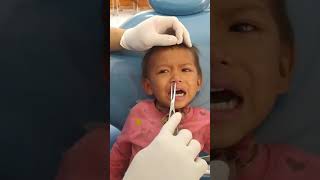 Viral Massive Worm on Kid Nose Shorts Worm Viral [upl. by Nyad]