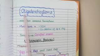 CNS Tumors  Robbins Pathology [upl. by Miguel]