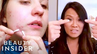 How To Pop A Pimple Yourself With Dr Pimple Popper  Beauty At Home [upl. by Norvan]