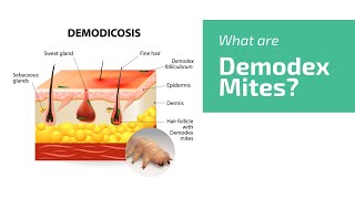 What Are Demodex Mites Face Mite Hair Mite  UNGEX [upl. by Orapma]