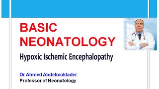 ABO incompatbility Rh hemolysis Part 3  Hyperbilirubinemia Tala Talks NICU [upl. by Donovan564]