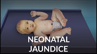 Neonatal Jaundice by L Veit  OPENPediatrics [upl. by Deelaw]