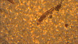 Plankton through the microscope [upl. by Minni]