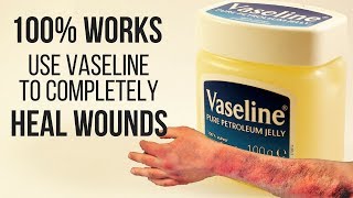 100 WORKS USE VASELINE TO COMPLETELY HEAL WOUNDS [upl. by Souvaine]