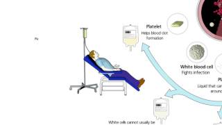 Fresh frozen plasmaFFPBlood component preparation [upl. by Theadora]