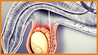 Introduction to the interpretation of Abdominal Ultrasound [upl. by Millan528]