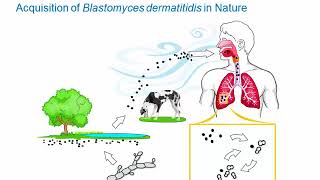 Dimorphic Fungi Blastomycosis Hot Topic [upl. by Brodsky]