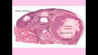 12DaysinMarch Ovarian Tumors for USMLE Step One [upl. by Newberry733]