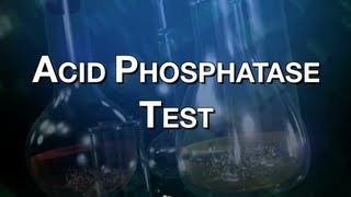 Acid Phosphatase Test [upl. by Arimihc]