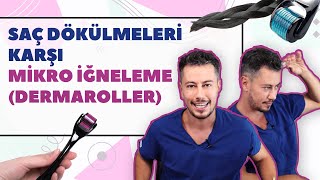 Saç Dökülmeleri Karşı Mikro İğneleme Dermaroller [upl. by Wiencke]