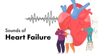 Female Heart Rate Increasing Speed Sound [upl. by Silsbye]