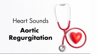 Aortic Regurgitation  Heart Sounds  MEDZCOOL [upl. by Aidile]