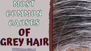 MOST COMMON CAUSES OF GREY HAIR [upl. by Ferree]