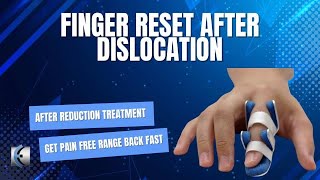 Finger Reset After Dislocation [upl. by Anirahc]