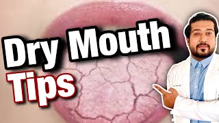 How to Treat Dry Mouth  Xerostomia Fix 2021 [upl. by Euqinitram]