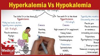 Hyperkalemia Vs Hypokalemia  EASY TO REMEMBER [upl. by Shedd]